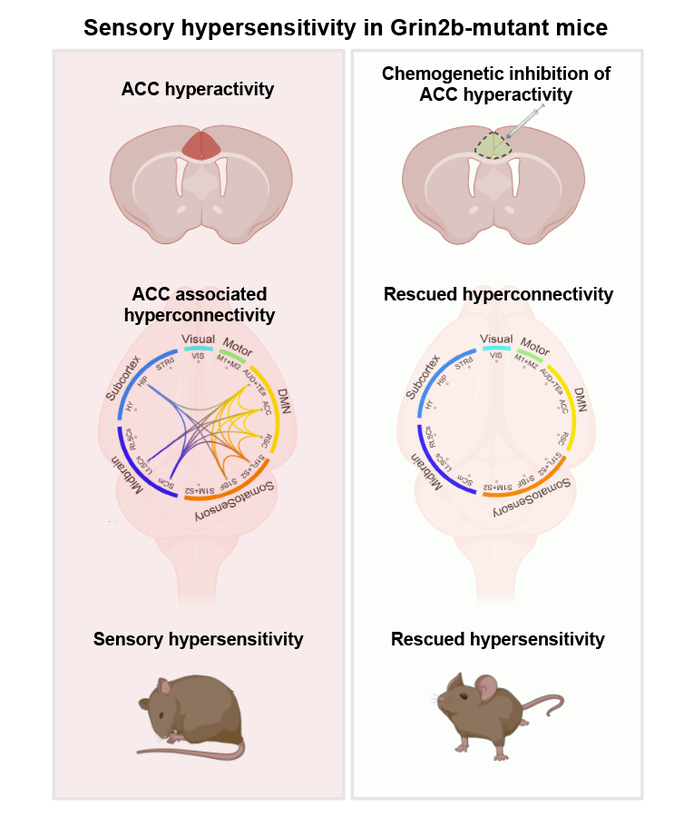 Brain Mechanisms Underlying Sensory Hypersensitivity in a Mouse Model of Autism Spectrum Disorder