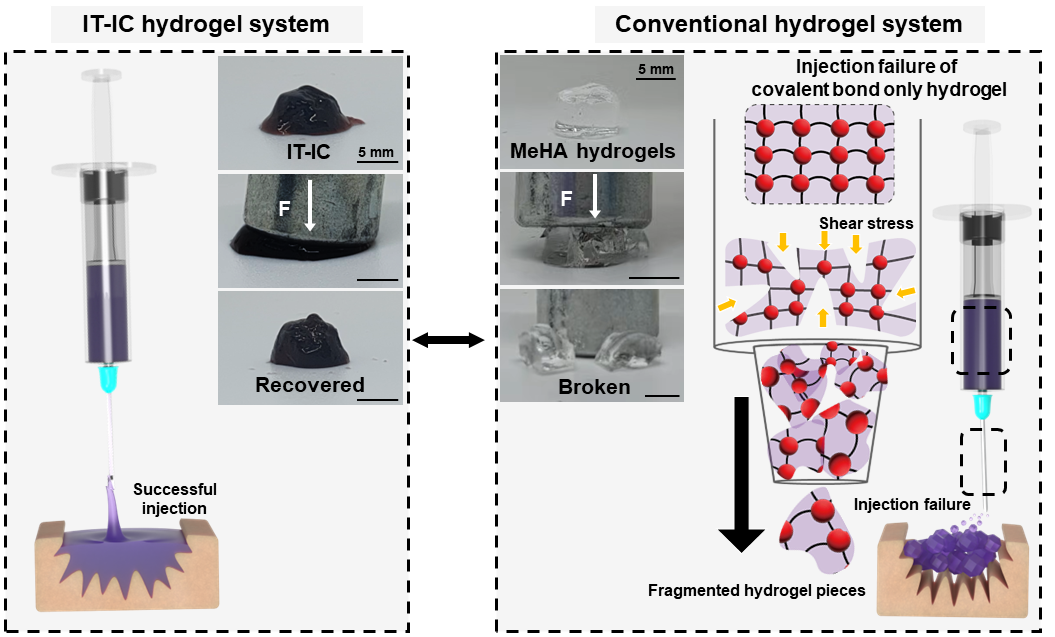 New “injectable tissue prosthesis coupled with closed-loop bioelectronic system” to aid in damaged muscle/nerve regeneration and robot-assisted reh... 사진