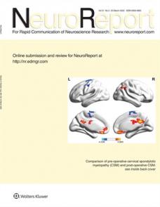 Perception of surface stickiness in different sensory modalities: an functional MRI study image