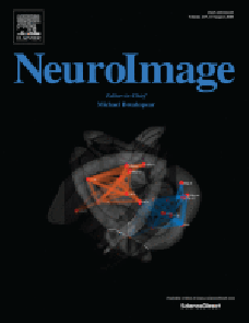 Distinct fMRI patterns colocalized in the cingulate cortex underlie the after-effects of cognitive control on pain image