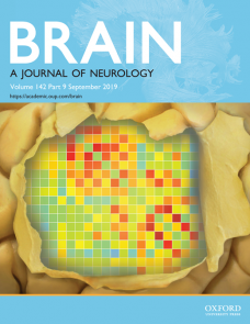 Locus coeruleus imaging as a biomarker for noradrenergic dysfunction in neurodegenerative diseases image