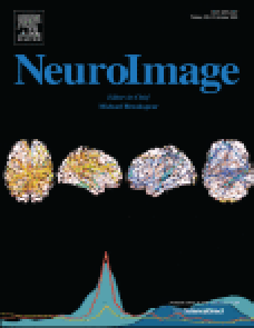 Feasibility of head-tilted brain scan to reduce susceptibility-induced signal loss in the prefrontal cortex in gradient echo-based imaging image