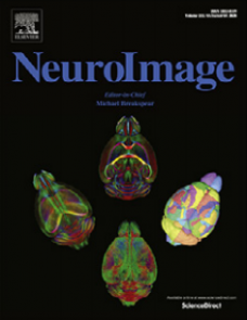 Postsynaptic activity of inhibitory neurons evokes hemodynamic fMRI responses image