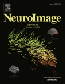 A Riemannian approach to predicting brain function from the structural connectome image