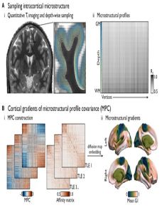Cortical microstructural gradients capture memory network reorganization in temporal lobe epilepsy image